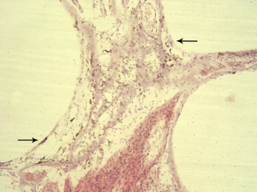 apical modiolus showing melanocytes
