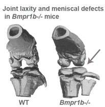 Illustrations of joint laxity and meniscal defects