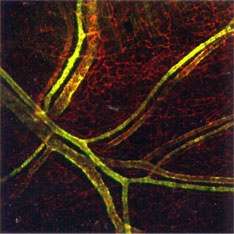 Normal vascular patterning in Ccn2-/- mice