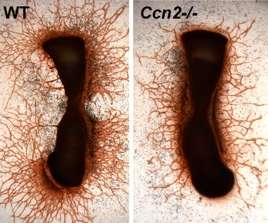 Comparison of WT and CCn2