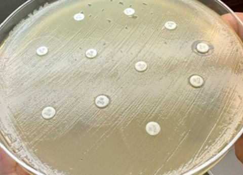 Molecular Microbiology and Pathogen Genomics experiment showing an Extensively Drug-Resistant Shigella in Southern California, 2022