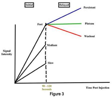 MRI Findings Kinetics Figure 3