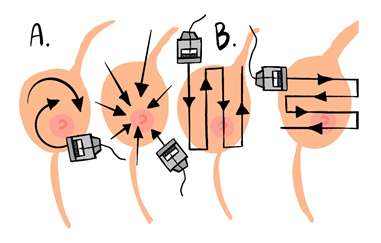 Basic of Breast Ultrasound Figure 1
