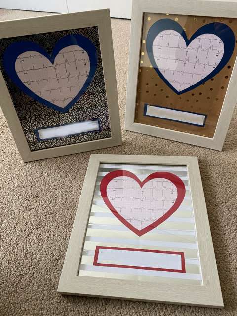 Framed EKG Keepsakes
