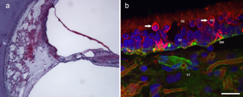 Immunohistochemical labeling of carbonic anhydrase in spiral ligament