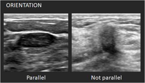 Ultrasounds Mass Orientation