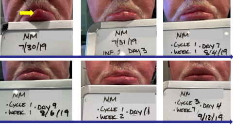 Progress of treatment