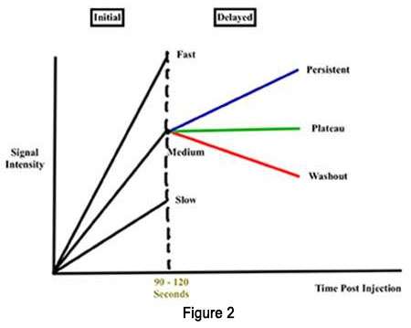 MRI Findings Kinetics Figure 2