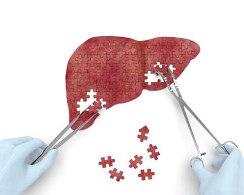 Surgeon using forceps to assemble a red liver-shaped puzzle