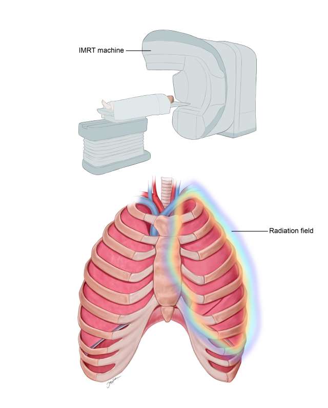 Diagram illustrating an MRI machine and a cross-section of the human lungs.