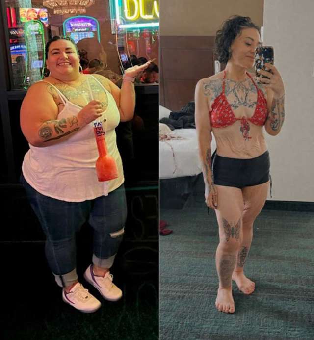 Jennifer before and after Gastric Sleeve Surgery at UCLA.