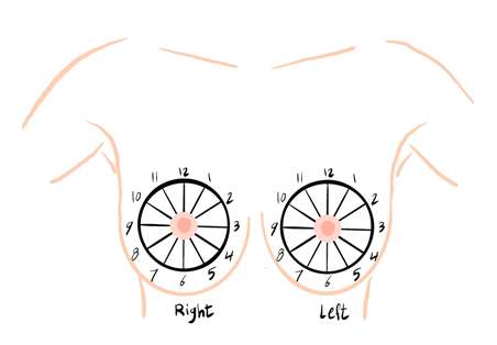 Basic of Breast Ultrasound Figure 2