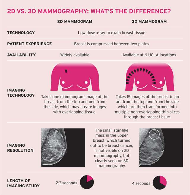 2D vs. 3D mammography infographic