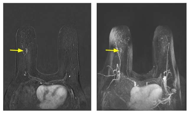 Mammography: High Risk Patient Population Figure 1