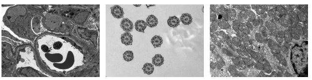 Electron Microscopy Photos
