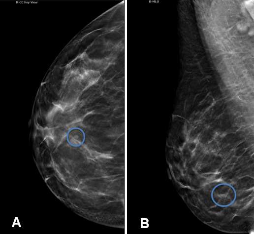 Case: Cysts figure 2