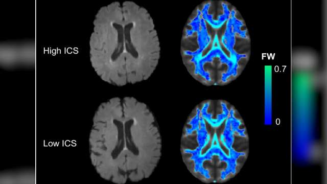 Two MRI brain slices labeled High ICS and Low ICS with corresponding colored FW maps