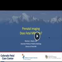 Fetal MRI Video Preview