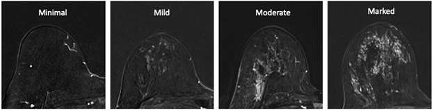 BI-RADS lexicon for the background parenchymal enhancement.