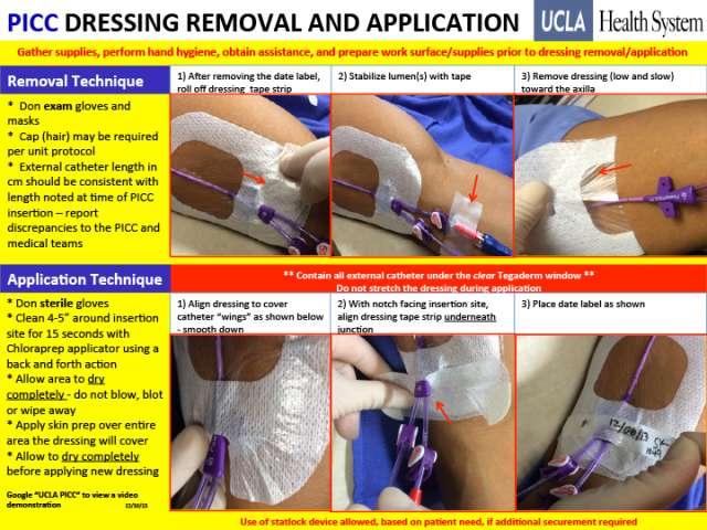 Radiology PICC Dressing Removal and Application