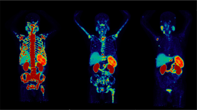 Three medical scans showing skeletal and organ structures in different poses.