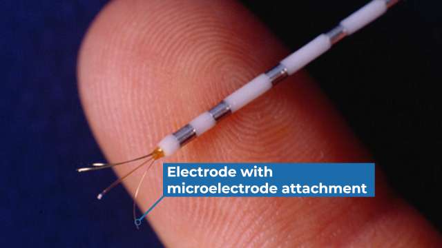 Finger holding thin electrode with microelectrode attachment