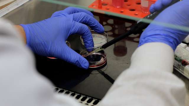 Researcher using pipette and petri dish