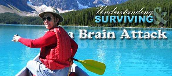 Understanding & Surviving a Brain Attack