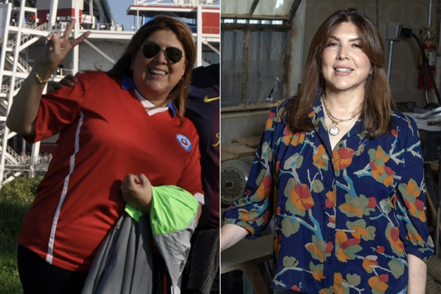 Lorena VSG before and after transformation