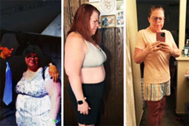 Darla VSG before and after transformation
