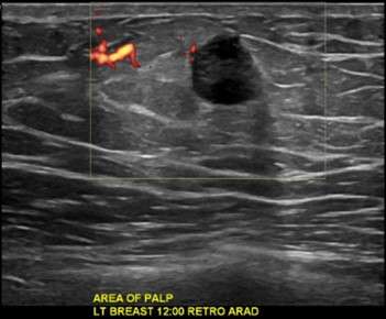 Case: Malignant Male Breast Lesions Figure 2