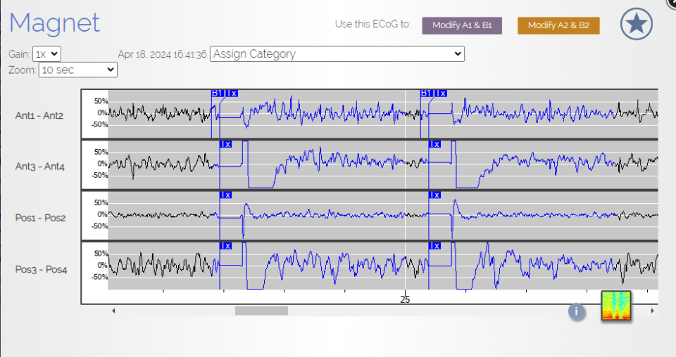 EEG recording 