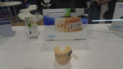 CSEM debuted a miniature in-mouth sensor, hinting at the next wave of passive, continuous health monitoring tech