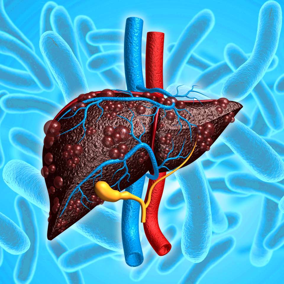 Liver Disease Microbiome