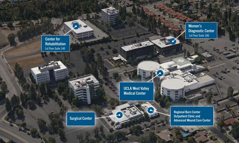 Aerial diagram of the UCLA West Valley Medical Center campus, labeling the main hospital and several satellite buildings.