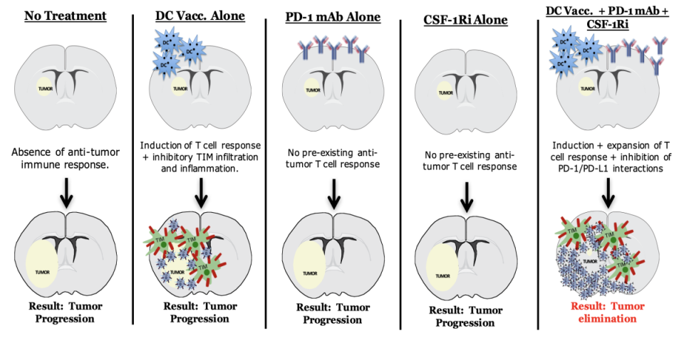 Targeting Immunotherapy-induced Resistance with DC Vaccination and Immune Modulation.
