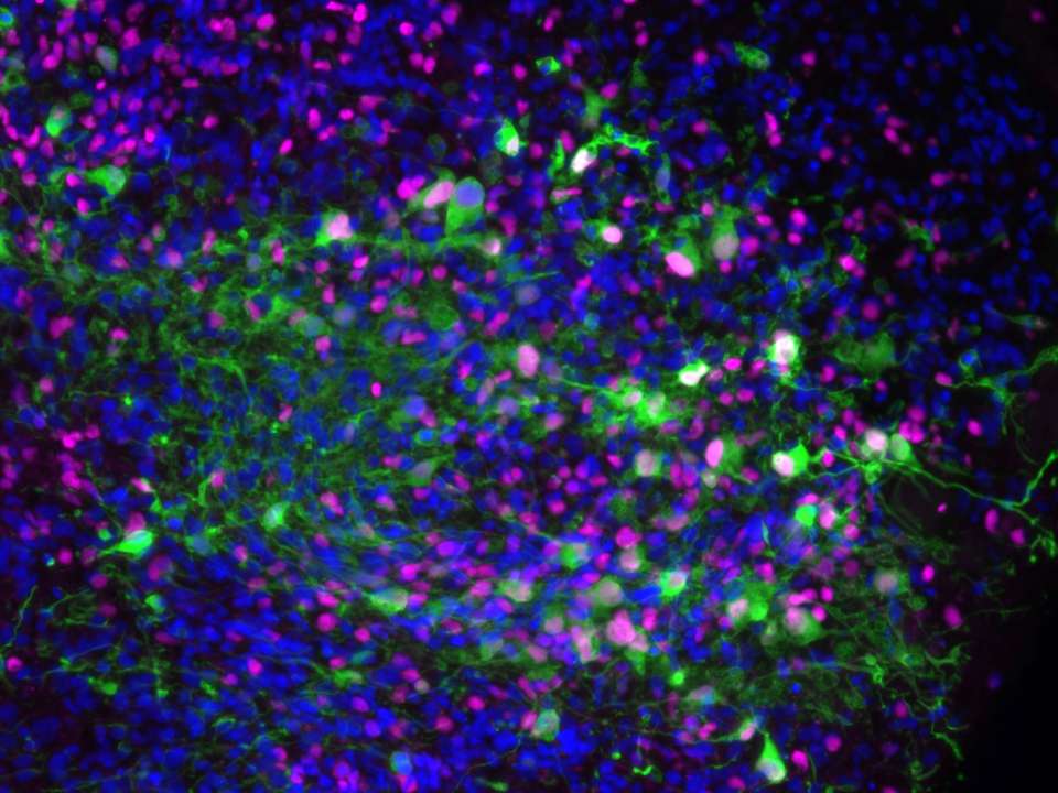 Fluorescent microscopy image showing dense neural cell clusters in vibrant colors.