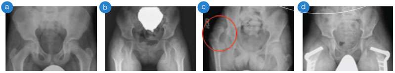 Orthopaedic Surgery X-Ray