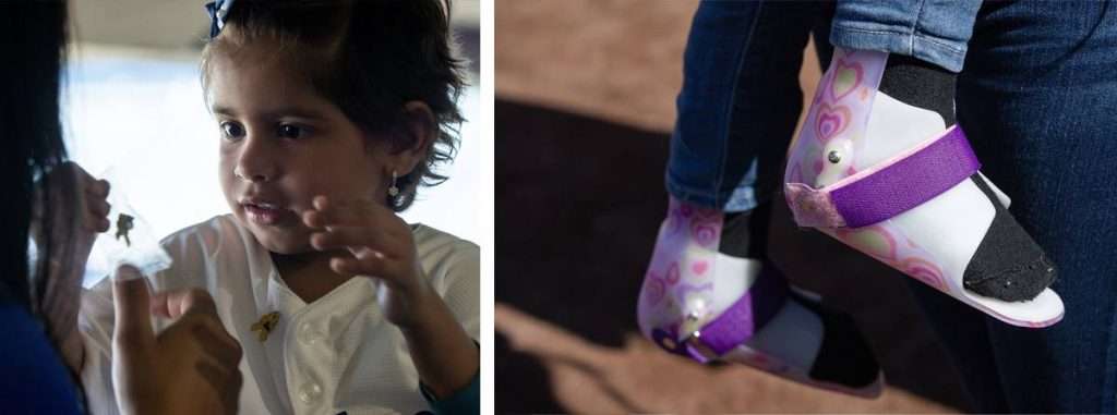 A diptych shows a young girl from the chest up and a close-up of her ankle-foot orthoses (AFOs). The AFOs are white with a purple strap.