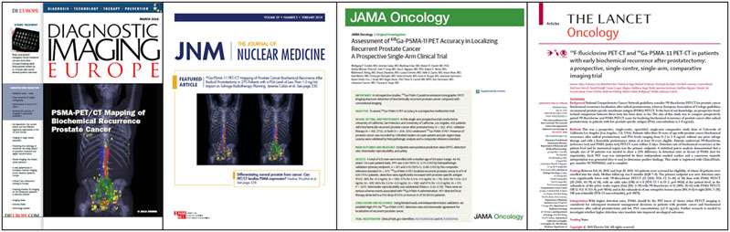 Examples of pioneering publications in PSMA related Theranostics research