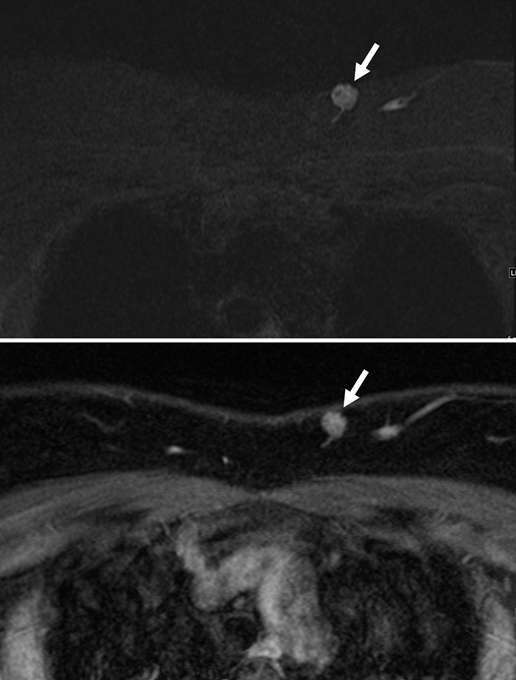 Case Vascular Abnormalities Radiology UCLA Health