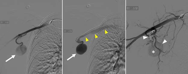 Case: Vascular Abnormalities - Radiology | UCLA Health