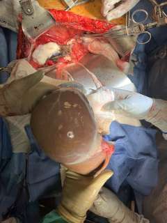 Fellow Training Experience 3