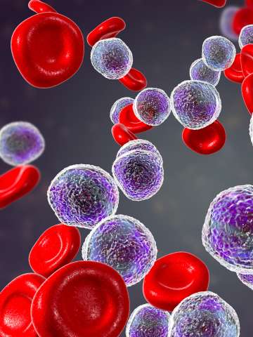 Leukemia cells Lymphoma cells
