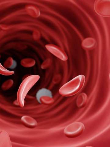 Close up of sickle cells