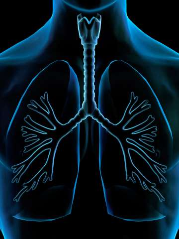 Lung Illustration, X-ray