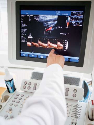 Monitor patients heart rate