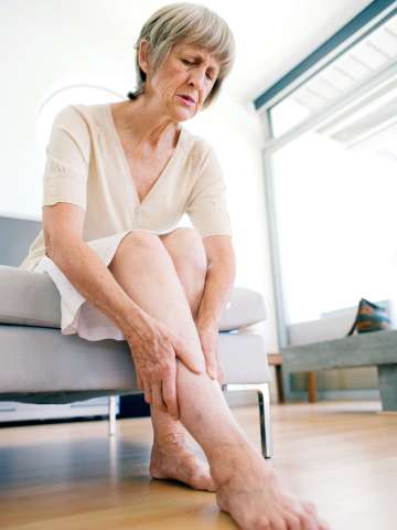 Varicose veins on elderly woman leg