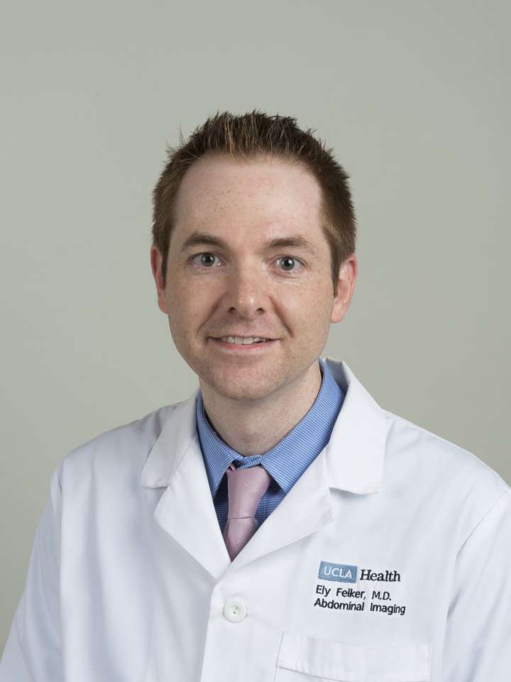Ely R. Felker, MD - Diagnostic Radiology | UCLA Health