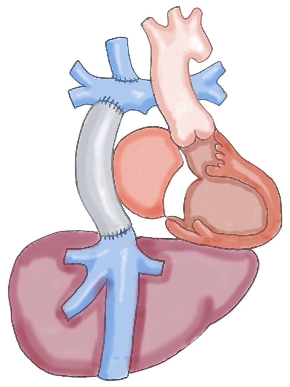 Treatments For Heart Liver Disease UCLA Health